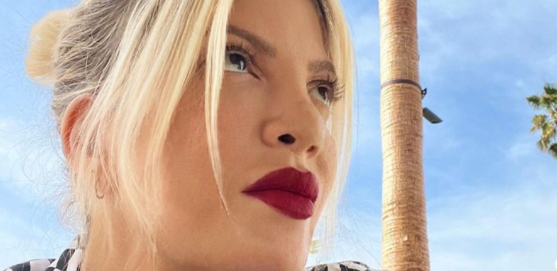 TORI SPELING U INVALIDSKIM KOLICIMA Glumica uslikana dok je izlazila iz bolnice, sva u modricama po licu i telu (FOTO)