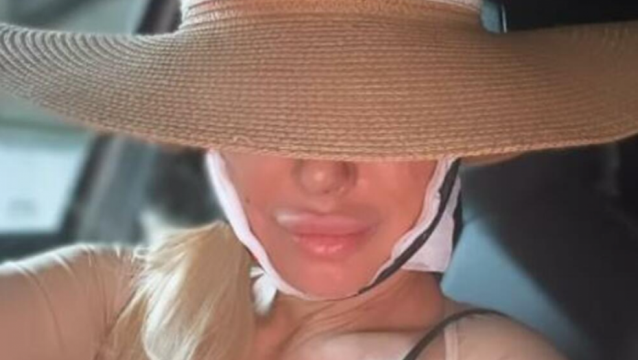 BEZ PLASTIKE NEMA FANTASTIKE Dušica Jakovljević ima manji nos, sredila je i podbradak i isisala salo FOTO
