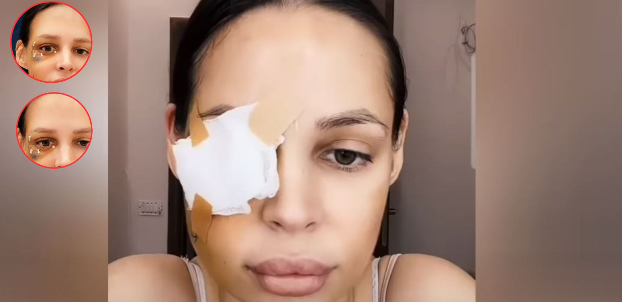 STRAVIČAN SNIMAK PRELOMA Nataša Šavija pokazala posledice nasilja, starleta pominje i samoubistvo!