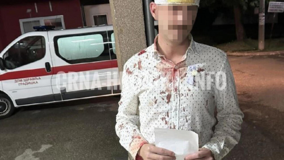 POGODILA GA ŠEMSA Stefan razbio sebi glavu u kafani zbog pesme, pa završio u hitnoj, a nalaz doktorke postao hit na internetu