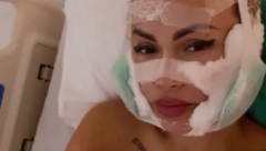 ERMINA PAŠOVIĆ HOSPITALIZOVANA Cela glava joj u zavojima, pojavile se uznemirujuće fotke! (FOTO)