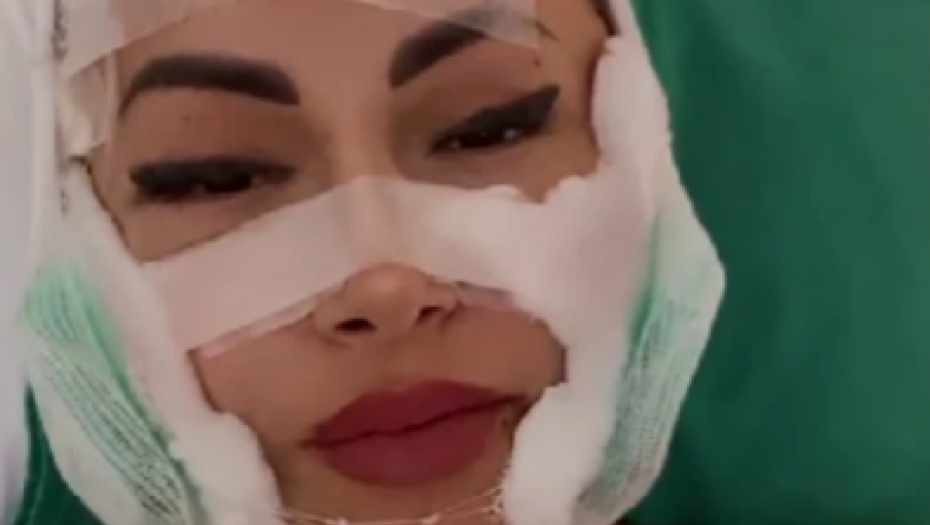 PLASTIČNIM OPERACIJAMA IZMENILA LIČNI OPIS Bivša zadrugarka iskeširala više od 15.000 evra i sad je druga žena!