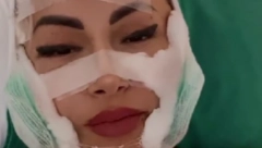 PLASTIČNIM OPERACIJAMA IZMENILA LIČNI OPIS Bivša zadrugarka iskeširala više od 15.000 evra i sad je druga žena!