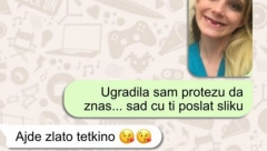 Tetka iz Nemačke mi je poslala 500 evra da uradim protezu: Bila sam ružna, svi su mi se smejali - a pogledajte me sada