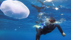 NOVOSAĐANKU OPEKLA OPASNA MEDUZA "Sve se desilo u sekundi, posledice su se odmah pojavile"