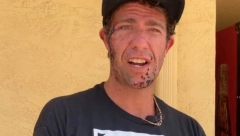 "ČUO SAM ZVUK KRCKANJA"! Marko je preživeo stravičan napad ajkule, a na licu ostali HOROR OŽILJCI