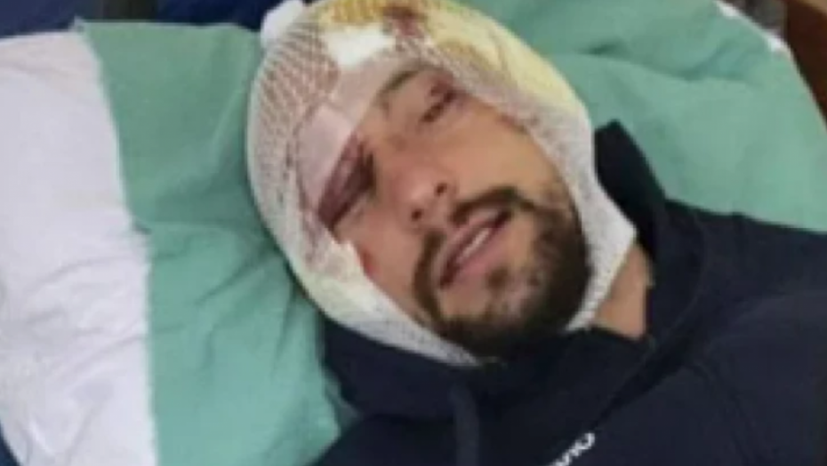 BIVŠI ZADRUGAR IMAO SAOBRAĆAJNU NESREĆU: Hitno hospitalizovan, uznemirujuće fotke!