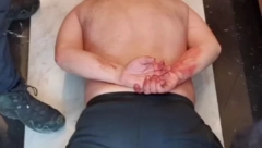 AFERA U HOTELU U BEOGRADU Crnogorac osumnjičen za jeziv napad na Kineskinju: Sumnja se da je ovo pravi razlog!