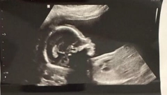 BILA JE NAJPOZNATIJA BEBA 90-IH Sada je bjavila sliku posle 20 godina (FOTO)