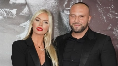 SUPRUGA POZNATOG PEVAČA ZGROŽENA! Osula paljbu po lažnoj zubarki: Ubacila je svoje lice u moje i to drži kao profilnu