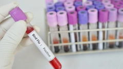 POSLEDNJI SLUČAJ REGISTROVAN JE 2021. U Republici Srpskoj utvrđeno prisustvo ptičijeg gripa