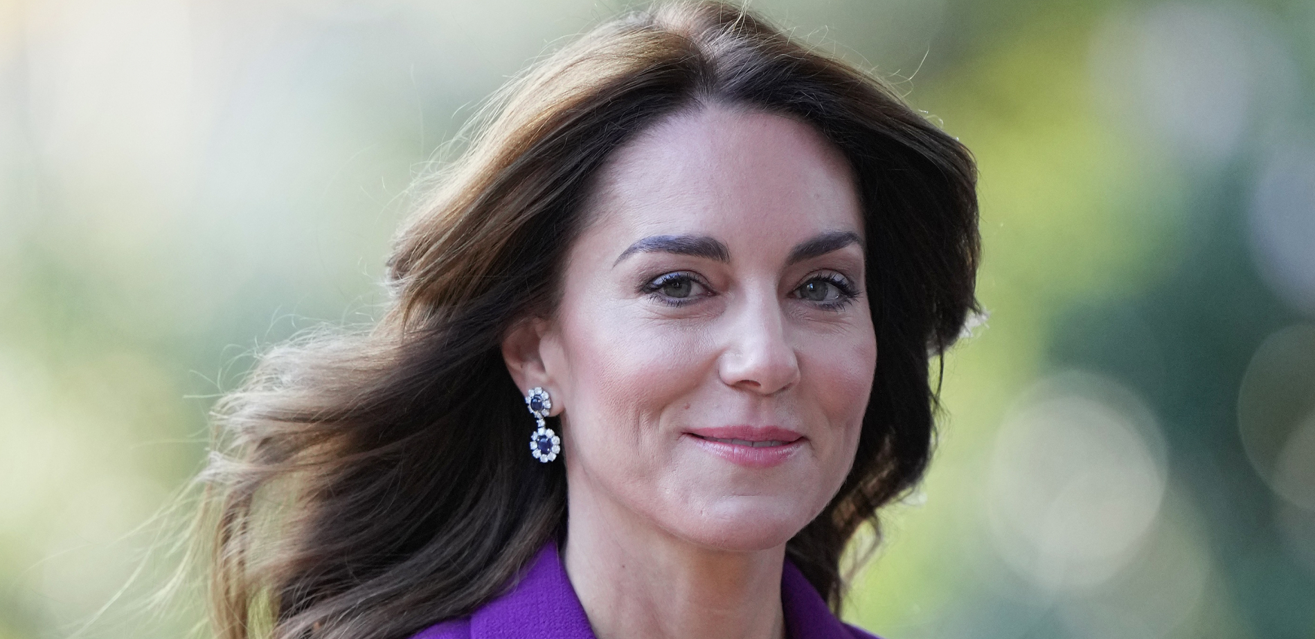 OPERACIJA KEJT MIDLTON BILA OZBILJNA? Pojavile se nove tvrdnje nakon zahvata koji je princeza u tajnosti imala