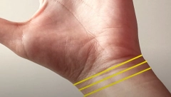 KOLIKO IH VI IMATE? Linije na zglobu otkrivaju koliko ćete novca imati, što ih je više, biće para kao pleve!