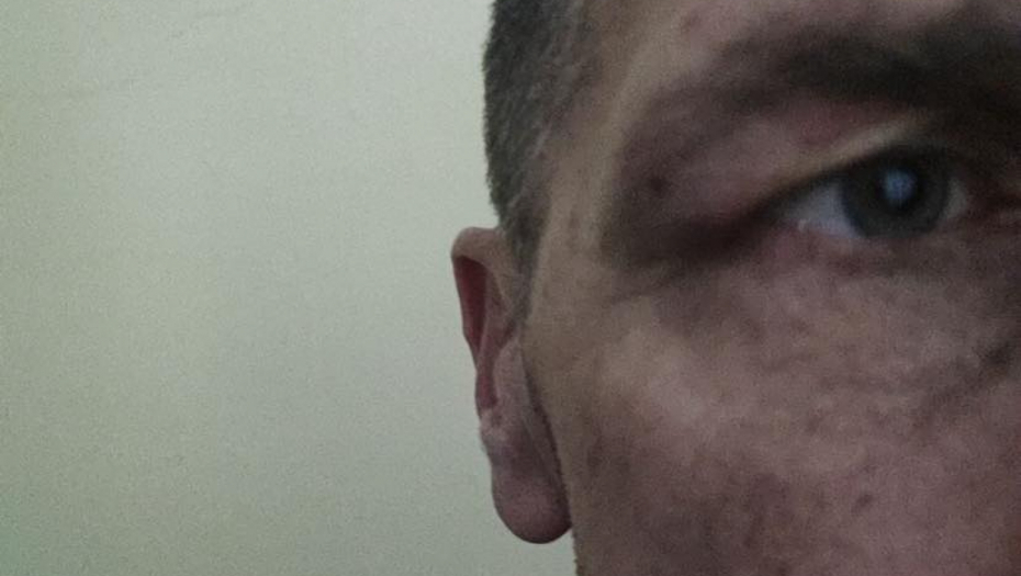 KURTIEVA POLICIJA UNAKAZILA SRBINA Milentija zaustavili na Brnjaku, preživeo je 8 sati mučenja (FOTO)