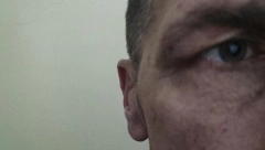 KURTIEVA POLICIJA UNAKAZILA SRBINA Milentija zaustavili na Brnjaku, preživeo je 8 sati mučenja (FOTO)