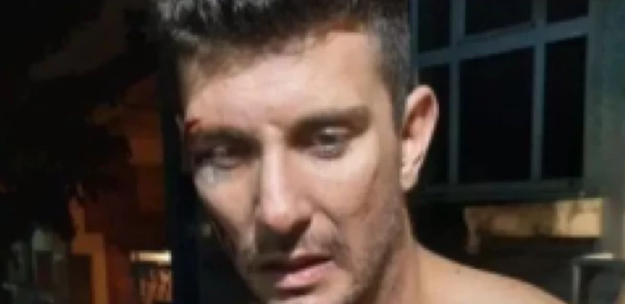 BIVŠI ZADRUGAR BRUTALNO PRETUČEN Maltretirali ga više sati, pa golog izbacili na ulicu!
