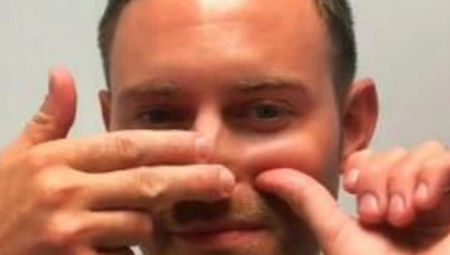 Doktor pokazao kako da otpušite nos za 15 sekundi: Ne kupujte kapi, one mogu da stvore zavisnost i štete sluzokoži