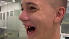 JANKO ZGROZIO JAVNOST Jutjuber uništio zdrave zube, stravični prizori!
