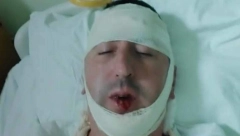 DOBIO VIŠESTRUKE PRELOME LOBANJE! Pavićevićević otkrio detalje brutalnog prebijanja u Nikšiću