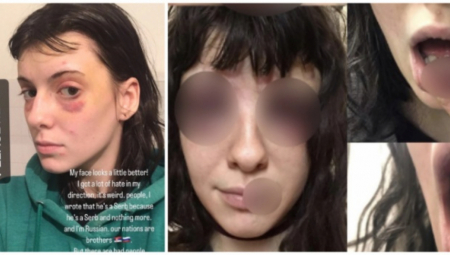 "LEŽALA SAM NA PODU I MOLILA GA DA PRESTANE DA ME BIJE" Jeziva ispovest Ruskinje (19) koju je pretukao dečko iz Srbije