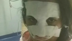 ĆERKA NAŠE GLUMICE KRVNIČKI PRETUČENA Muškarac joj slomio nos, hitno završila u Urgentnom centru