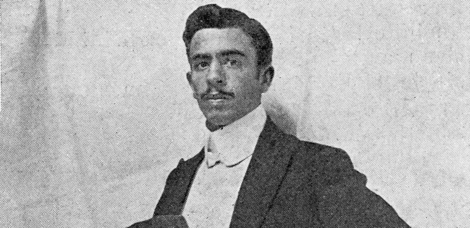 NEVEROVATNO, ALI ISTINITO! Parazitski blizanac mu je virio iz stomaka, bio je najčudniji muškarac svog vremena (FOTO)