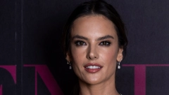 SA 11 GODINA IMALA PRVU PLASTIČNU OPERACIJU Stare fotke Alesandre Ambrozio zgrozile fanove, pitaju se kako je uopšte postala supermodel