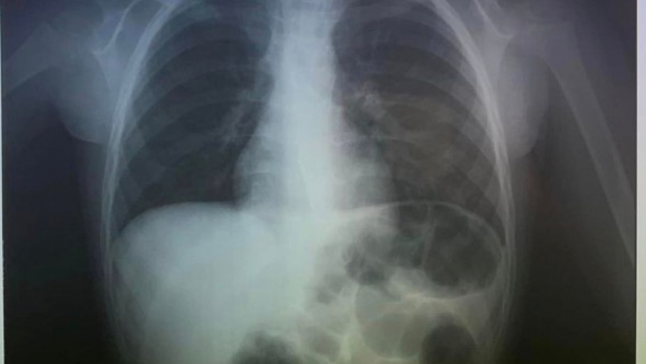 DEČAK PROGUTAO NOVČIĆ, GLEDAJTE GDE JE ZAVRŠIO Drama porodice na Kritu na dočeku