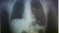 DEČAK PROGUTAO NOVČIĆ, GLEDAJTE GDE JE ZAVRŠIO Drama porodice na Kritu na dočeku