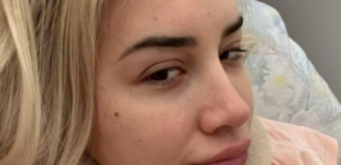 POZNATA PEVAČICA DOŽIVELA STRAŠNU NEZGODU! Procurile njene fotke iz bolnice, evo kako sada izgleda