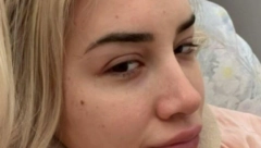 POZNATA PEVAČICA DOŽIVELA STRAŠNU NEZGODU! Procurile njene fotke iz bolnice, evo kako sada izgleda