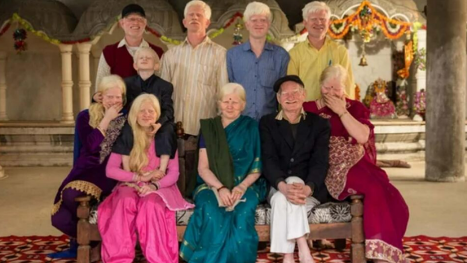 UŠLI SU U GINISOVU KNJIGU REKORDA Ovo je najveća ALBINO PORODICA na svetu (FOTO)