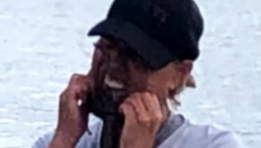 KAMERA SVE SNIMILA Uzela hobotnicu i stavila je na lice, pa završila u bolnici (VIDEO)