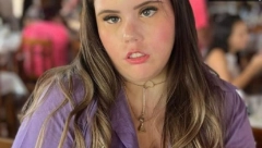 OVA DEVOJKA NE ZNA ŠTA JE OSMEH Ne može da se nasmeje, zatvori usta, niti da pokaže bilo kakvu emociju (FOTO)