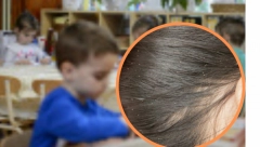 ŠEST HILJADA DINARA DA VAM FRIZER ISTREBI VAŠKE - Majstori frizura našli mnogo isplativiju uslugu, EVO KAKO TO RADE