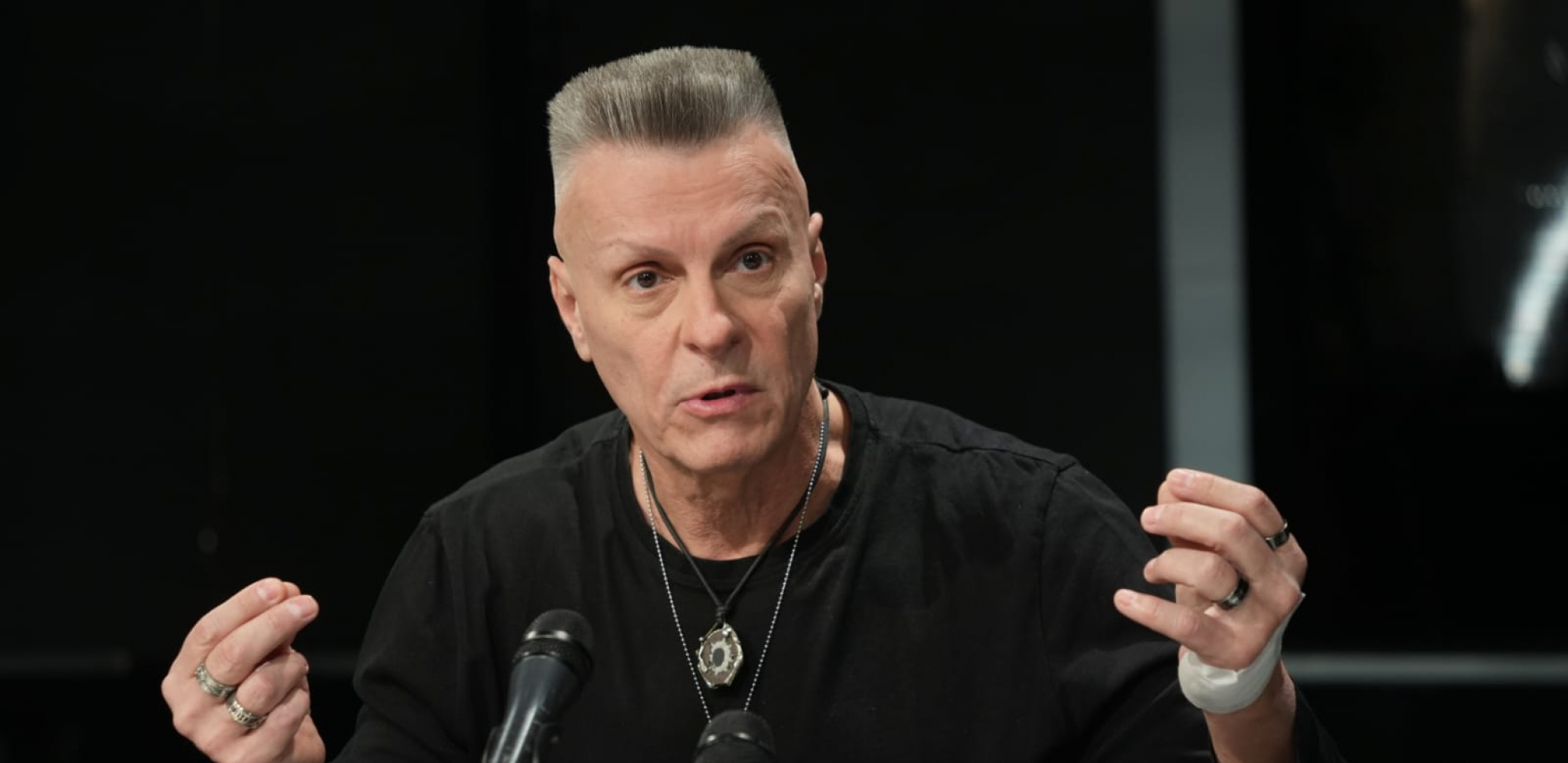 MUZIČAR POKAZAO JEZIVE POVREDE NAKON STRAVIČNE NESREĆE Šavovi na ruci, Đorđe David otkrio i šta ga je spasilo