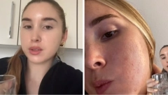 MINIMALISTIČKA NEGA KOŽE JE SVE VIŠE U TRENDU Dermatolog dala zlata vredan savet kako treba da izgleda bjuti rutina
