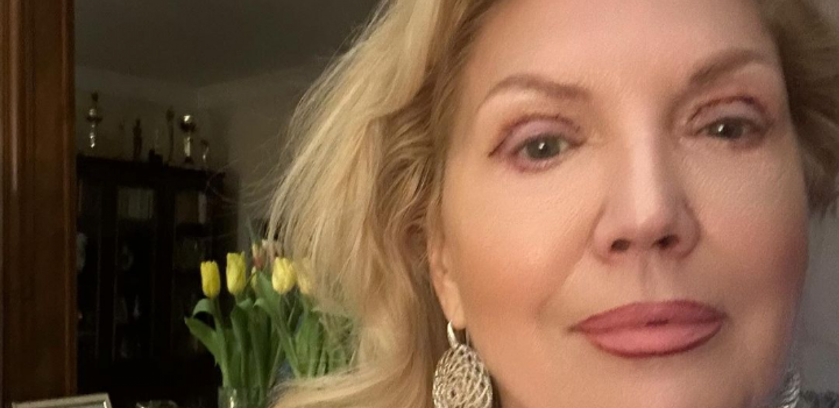 BILA SAM U TOTALNOJ ANESTEZIJI, MIRNO OTIŠLA NA OPERACIJU Suzana Mančić više ne izgleda isto, evo zbog čega je otišla pod nož!