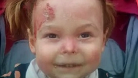 SJAJNA VEST IZ RFZO! Maloj Nađi (4) iz Čačka O TROŠKU DRŽAVE jedini lek za decu-leptire! Košta 630.000 dolara