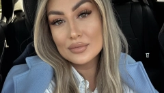 MOJA PRVA HEMIOTERAPIJA! Pevačica prvi put progovorila o svojoj borbi sa rakom: Za svaku ženu je najteže ostati bez kose!