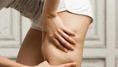 CELULIT MOŽE ZAŠTITITI OD OVIH OPAKIH BOLESTI Naučnici došli do izuzetnih otkrića, a evo šta su rezultati studije pokazali