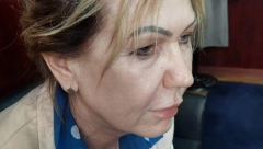 UŽAS U BEOGRADU Napadnuta još jedna aktivistkinja SNS, ima povrede glave (VIDEO)