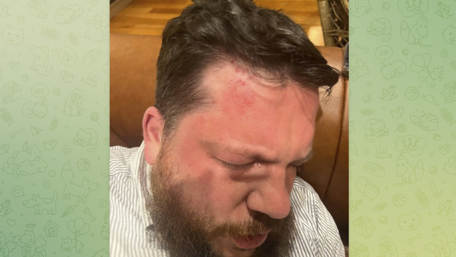 OGLASIO SE RUSKI OPOZICIONAR NAKON NAPADA Dan pre spomenuo je njega (FOTO)