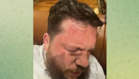OGLASIO SE RUSKI OPOZICIONAR NAKON NAPADA Dan pre spomenuo je njega (FOTO)