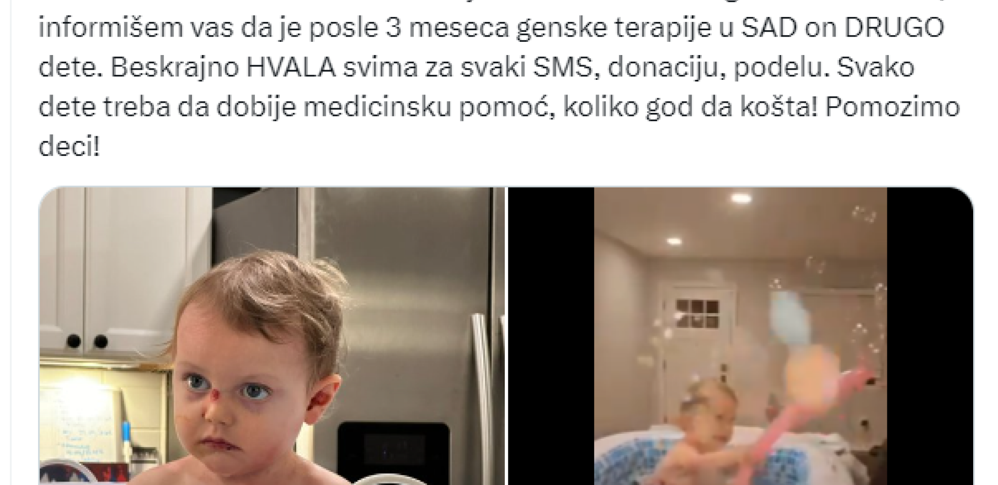 CELA SRBIJA JE NAVIJALA ZA NJEGA Viktor se rodio kao dete-leptir i ceo život znao je samo za bol, a pogledajte ga sada