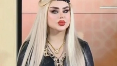 VIŠE NIKO NE MOŽE DA JE PREPOZNA Ovako izgleda BARBIKA IZ IRAKA posle 50 plastičnih operacija (FOTO)