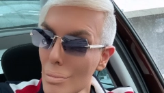 OVAKO JE BOKI 13 IZGLEDAO PRE SVIH OPERACIJA I BEZ ŠMINKE Isplivala slika iz mlađih dana, nikada ga ne biste prepoznali!