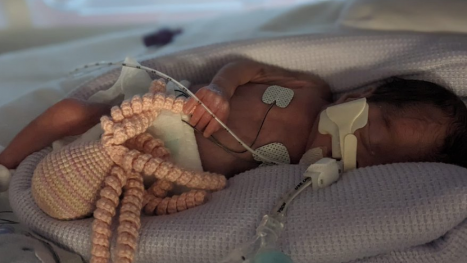 NJIHOVU BORBU ZA ŽIVOT PRATIO JE CEO SVET Bliznakinje rođene sa pet nedelja razmaka! (FOTO/VIDEO)