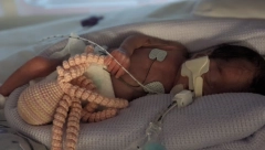 NJIHOVU BORBU ZA ŽIVOT PRATIO JE CEO SVET Bliznakinje rođene sa pet nedelja razmaka! (FOTO/VIDEO)