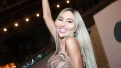 NA FILERE DALA ČITAVO BOGATSTVO Ova devojka ima NAJVEĆE OBRAZE na svetu, a evo kako je izgledala ranije (FOTO)